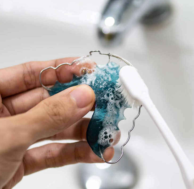 How do I take care of my retainers? How do I take care of my retainers?