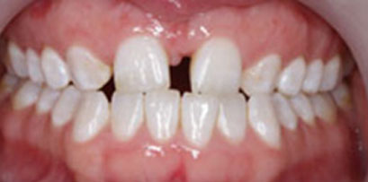 Before & Afters Before & Afters