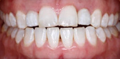 Before & Afters Before & Afters