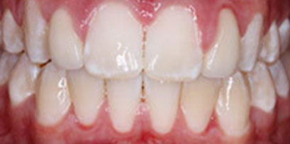 Before & Afters Before & Afters