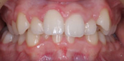 Before & Afters Before & Afters