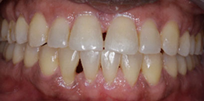 Before & Afters Before & Afters