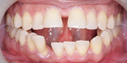 Before & Afters Before & Afters