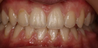 Before & Afters Before & Afters