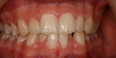 Before & Afters Before & Afters