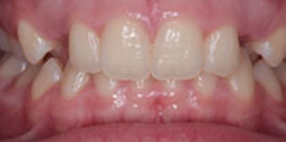 Before & Afters Before & Afters