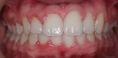 Before & Afters Before & Afters