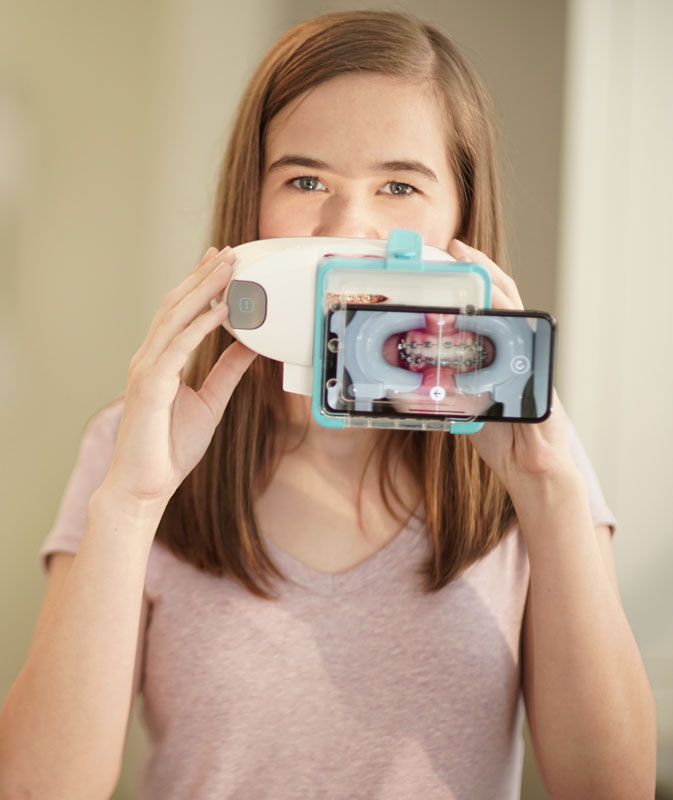 What is Dental Monitoring? What is Dental Monitoring?