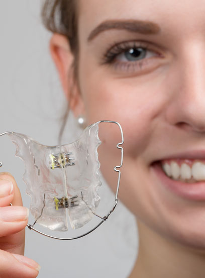 Retainer FAQs Retainer FAQs