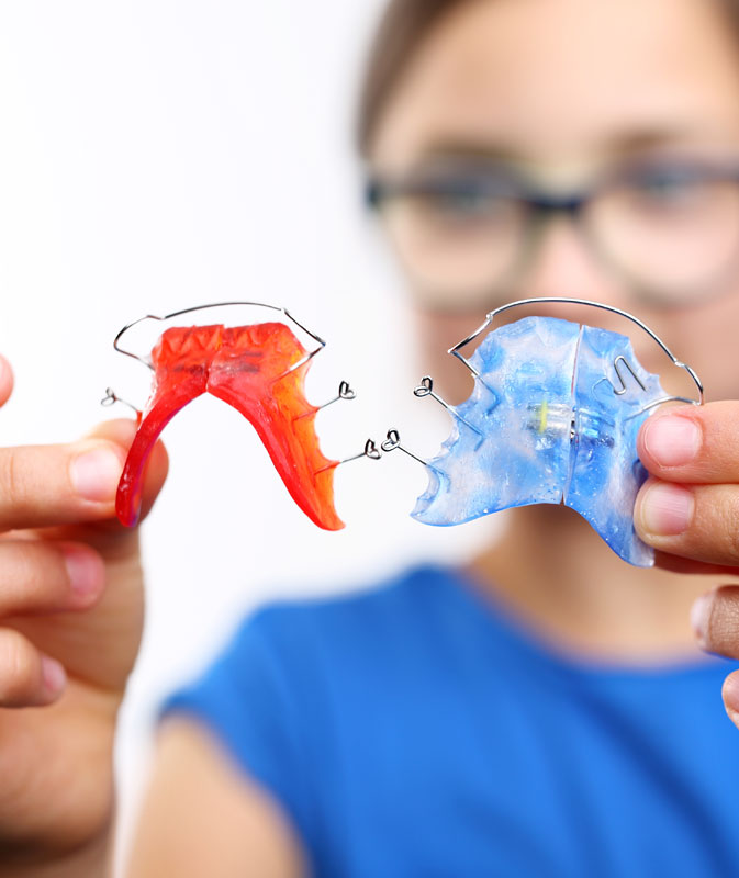 What are the types of retainers? What are the types of retainers?