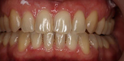 Before & Afters Before & Afters