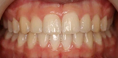 Before & Afters Before & Afters