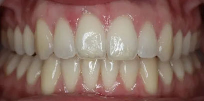 Before & Afters Before & Afters