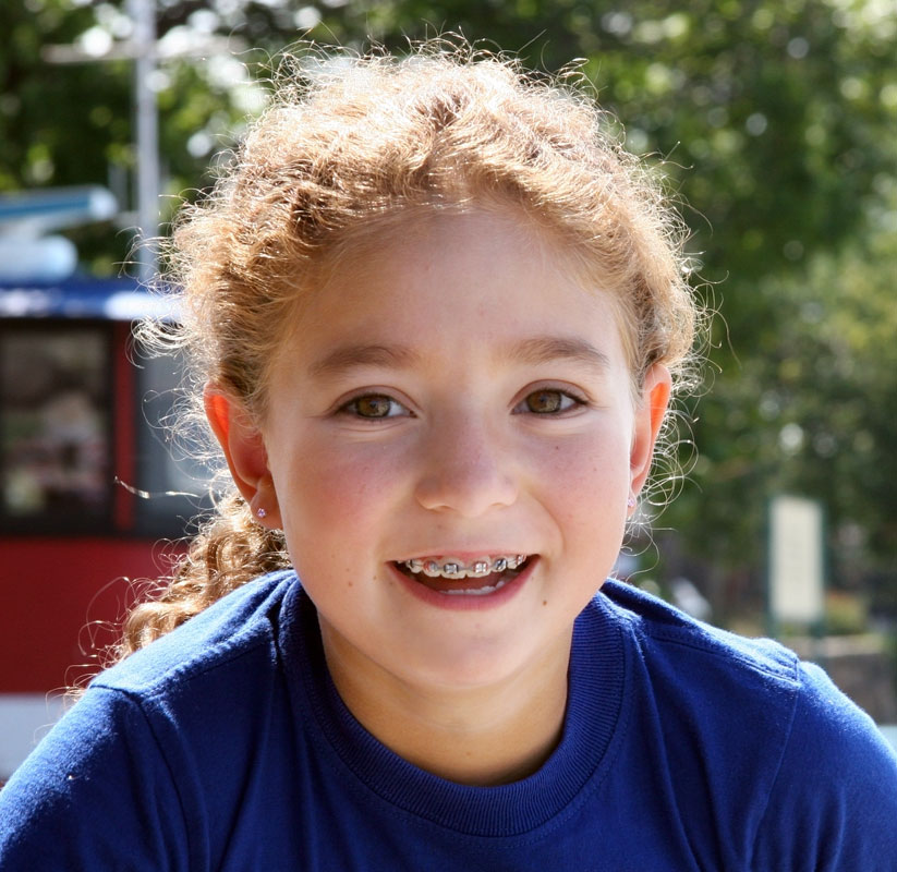 Invisalign® First Invisalign® First