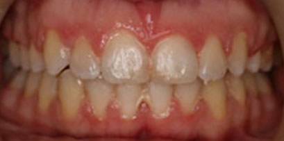 Before & Afters Before & Afters