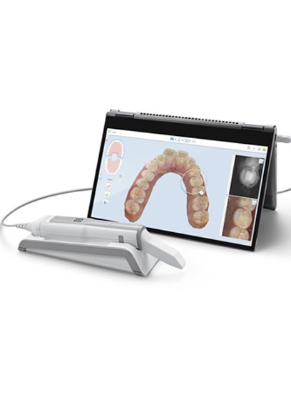 Dental Monitoring Dental Monitoring