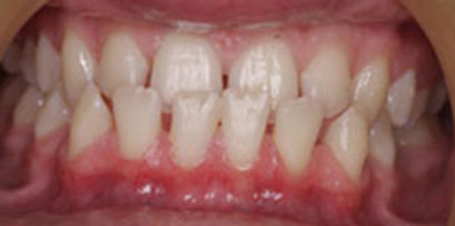 Before & Afters Before & Afters