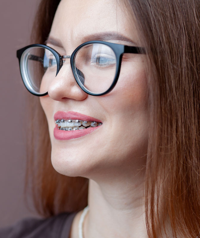 Types of braces we offer Types of braces we offer