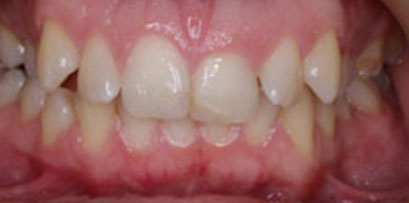 Before & Afters Before & Afters