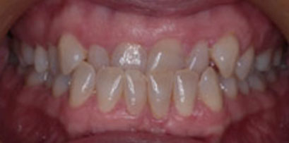 Before & Afters Before & Afters