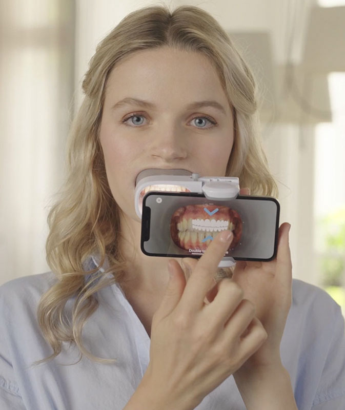 How does Dental Monitoring work? How does Dental Monitoring work?