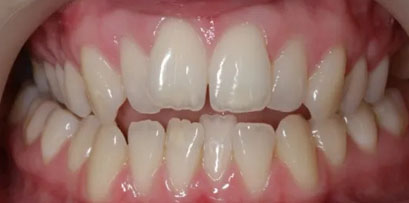 Before & Afters Before & Afters