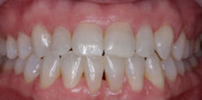 Before & Afters Before & Afters