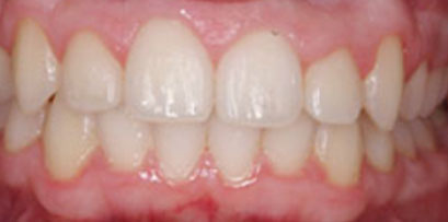 Before & Afters Before & Afters